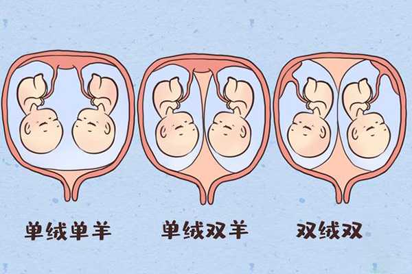 <b>不孕不育夫妻做供精试管婴儿能生多胞胎吗</b>